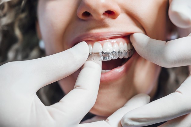 Invisalign Dentists Southampton