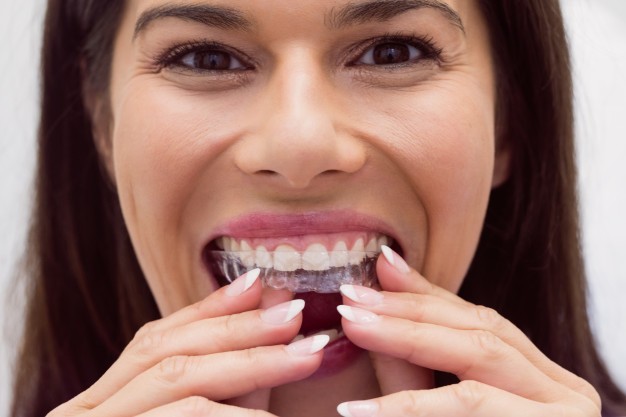 Invisalign Southampton