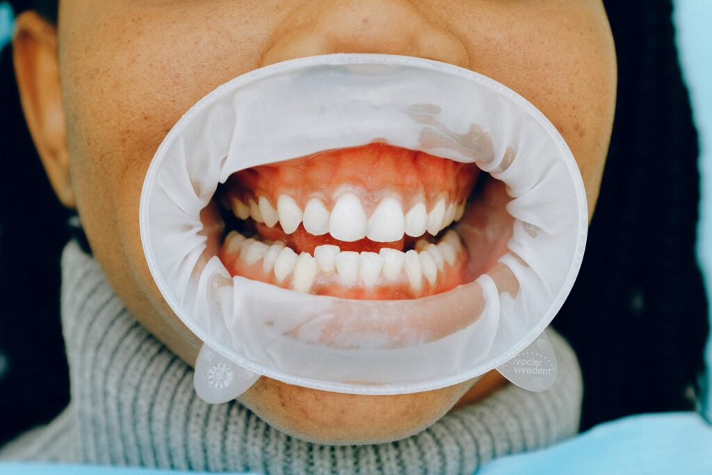 Invisalign treatments Southampton