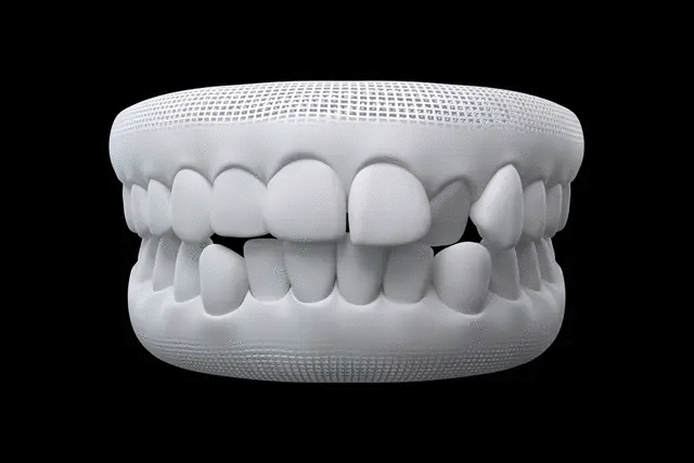 3D Teeth Modelling Technology
