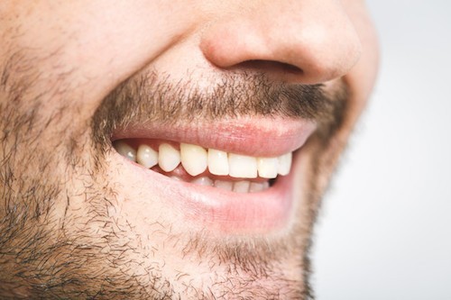 Invisalign Treatment Southampton