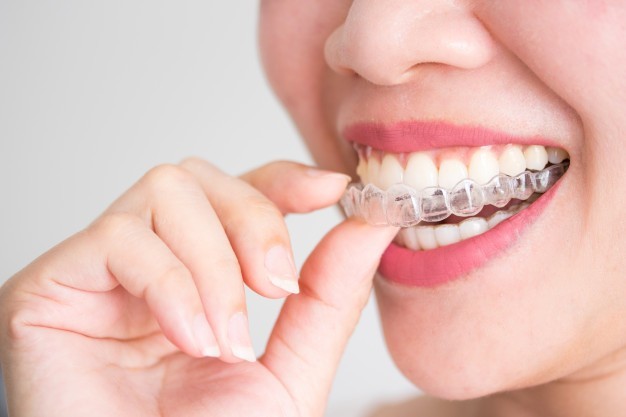 Invisalign Provider Southampton