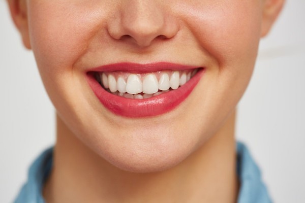Invisalign Treatment Southampton
