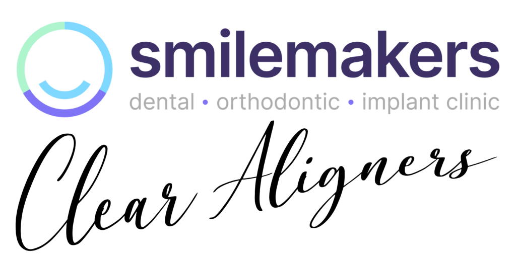 clear aligners Southampton
