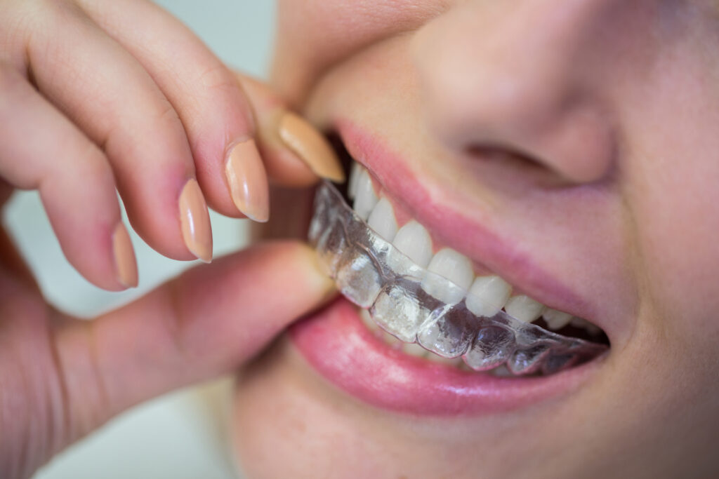 person taking our their clear invisaligners